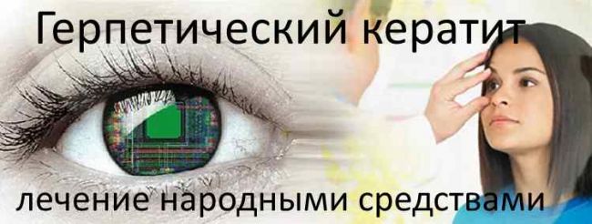 Кератит глаза народные средства