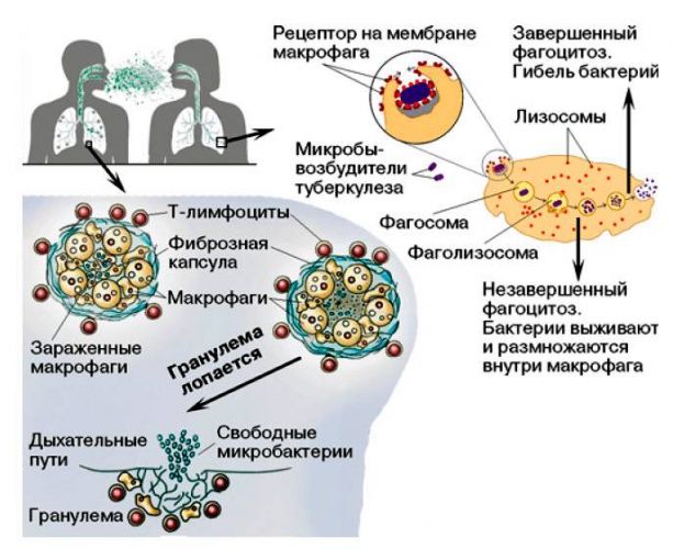 Mycobacterium tuberculosis