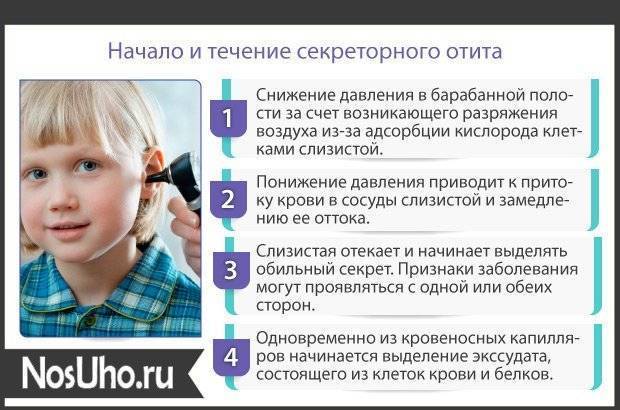 После простуды заложило уши – что делать и чем лечить