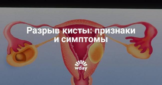 Питание после лапароскопии кисты яичника