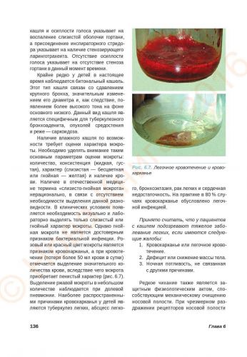 Почему возникает кровохарканье при пневмонии?