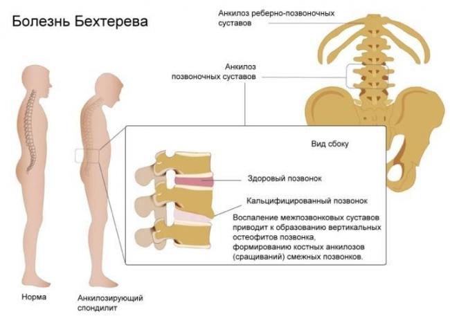 Болит поясница после сна: подробное описание причин