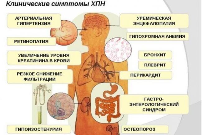 Пролактин