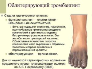 Симптомы и лечение болезни бюргера