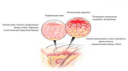 Красные чешущиеся пятна на теле