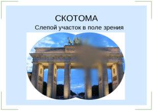 Лечение гемианопсии после инсульта