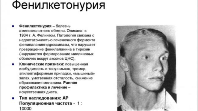 Фенилкетонурия – что это за заболевание, почему оно возникает, и как лечить кроху?
