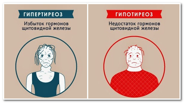 Ттг у женщин – таблица норм для разных возрастов. что делать, если ттг повышен?