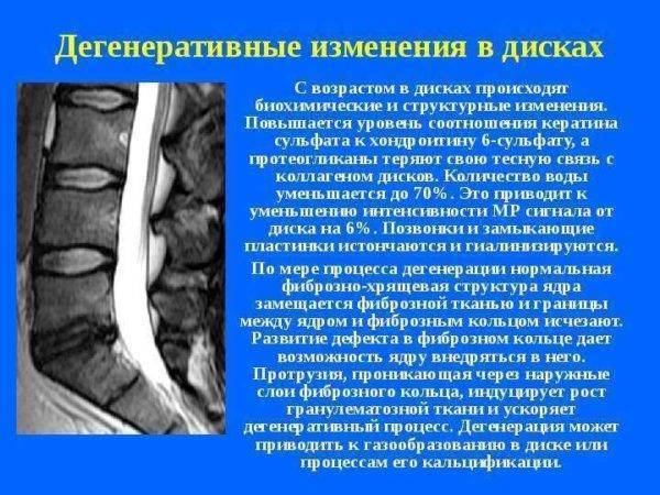 Постизометрическая релаксация мышц: упражнения для правильного положения всех отделов позвоночника