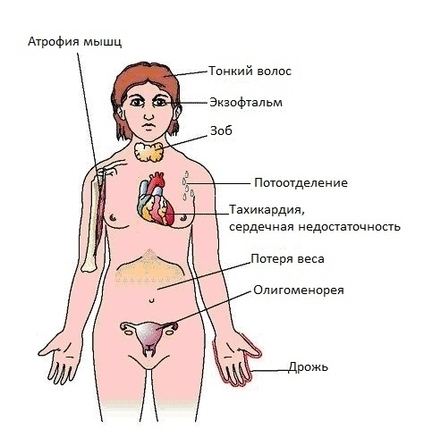 Общие заболевания и проблемы с щитовидной железой у женщин, чем они опасны и как их лечить?