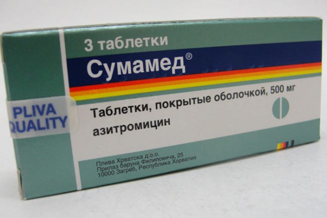 Симптомы и лечение фолликулярной ангины у детей
