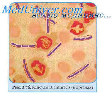 Сибирская язва (bacillus anthracis): характеристика возбудителя, заражение, симптоматика, диагностика, лечение