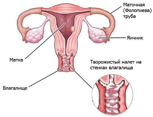 Свечи, мазь клотримазол: инструкция, цена и отзывы