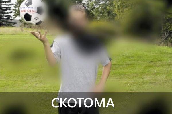 Лечение гемианопсии после инсульта