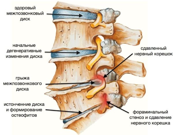 Инструкция по применению препарата дона