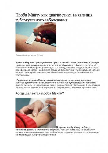 Как выглядит реакция манту в норме у детей?
