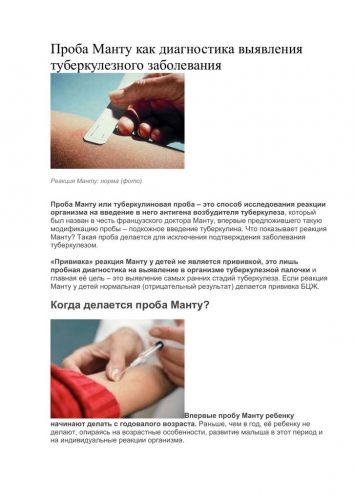Зачем ежегодно нашим детям делают реакцию манту? какой она должна быть в норме у детей?