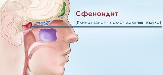 Реабилитация после септопластики (пластики носовой перегородки) - отзывы, фото