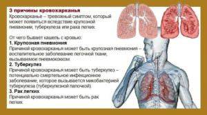 Кровь в слюне без кашля: причины появления, признак чего