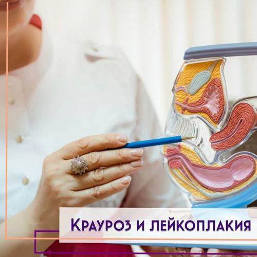 Лечение лейкоплакии и крауроза народными средствами