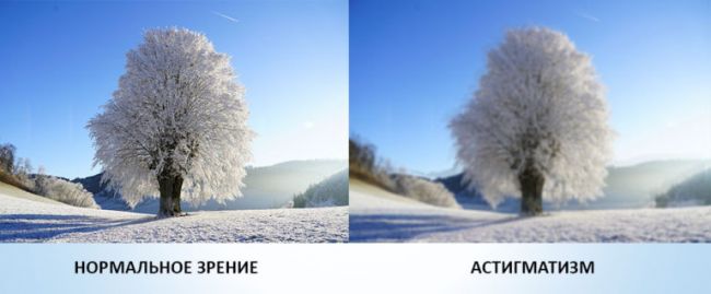 2 в 1 – близорукость и астигматизм сразу.как бороться?