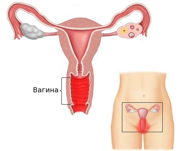 Вульвит: симптомы, причины, лечение. какие виды заболевания встречаются у девочек и женщин?