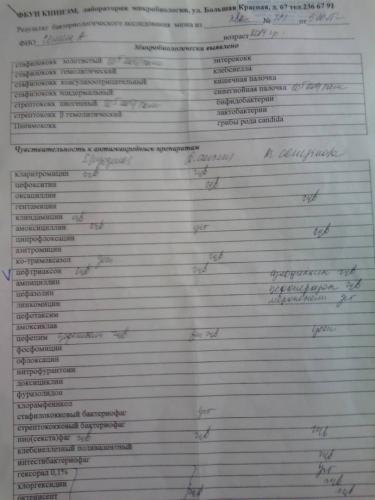 Лечение аденоидов 2 степени