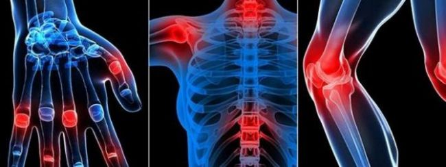 Glucosamine chondroitin msm. отзывы, инструкция, противопоказания, побочные эффекты