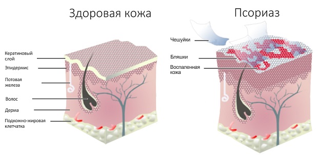 Элоком мазь
