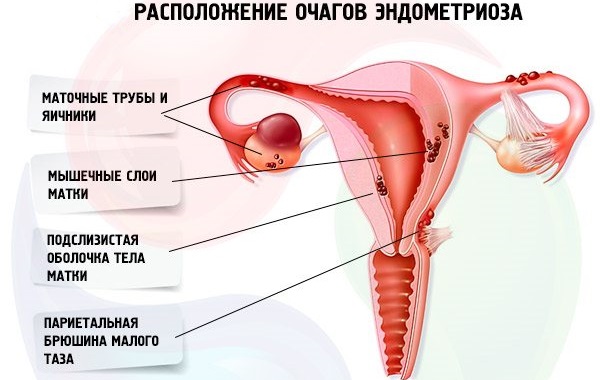 Климаксан. инструкция по применению, цена, отзывы женщин и врачей. применение таблеток при климаксе, состав, аналоги, противопоказания