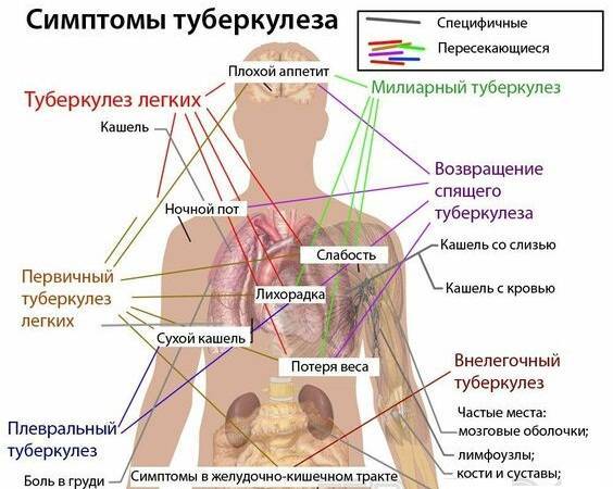 Инкубационный период туберкулеза: что это такое, как долго длится?