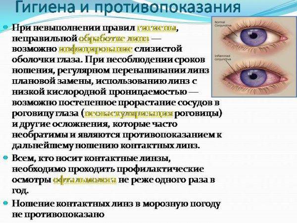 Пролонгированный режим ношения линз это мягкие линзы длительного какие выбрать уход контактные