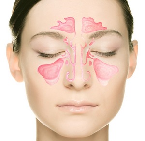 Синуфорте: инструкция по применению, аналоги и отзывы, цены в аптеках россии