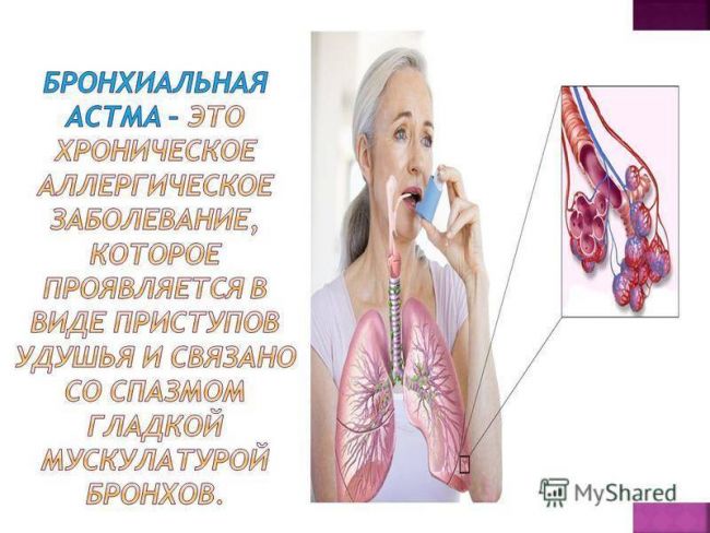 Неотложная помощь при приступе бронхиальной астмы у детей