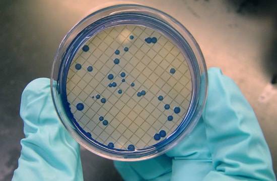 Кишечная палочка (escherichia coli), гкб, окб, ткб