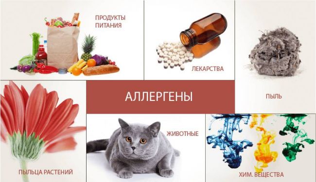 Аллергия на манту