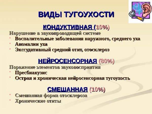 Сенсоневральная тугоухость 1, 2, 3, 4 степени: симптомы, лечение