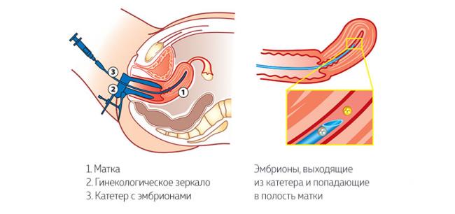 Как собрать пурегон? - запись пользователя свеttик (svettikfil) в сообществе эко - мама в категории медикаменты (лечение,хранение) - babyblog.ru