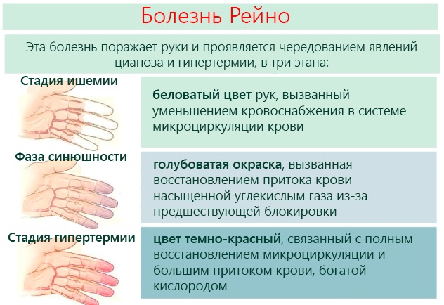 Онемение лица и головы признак какой болезни