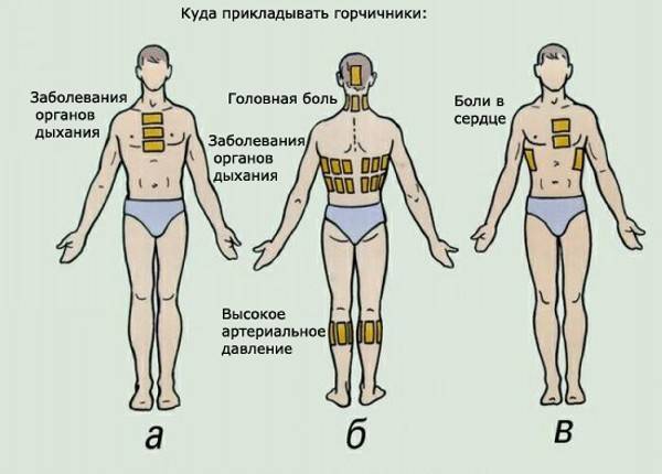 Применение перцового пластыря