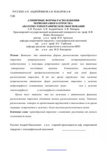 Признаки аппендицита