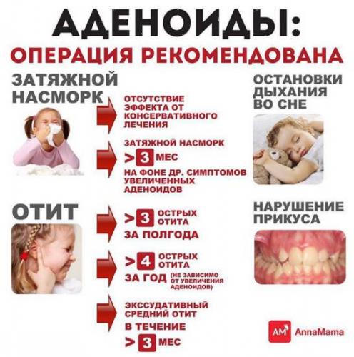 Как лечить аденоиды у ребенка: советы педиатра