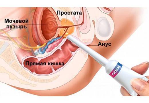 Микролакс - официальная инструкция по применению