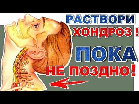 Массаж при остеохондрозе шейного отдела позвоночника (как делать)