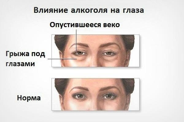 Глаза наркомана, как признак употребления наркотиков