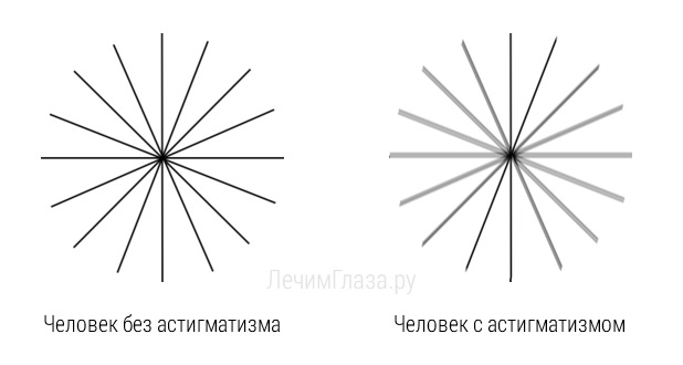 Чем отличается близорукость от дальнозоркости и астигматизма