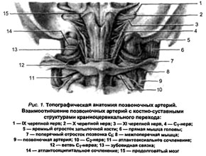 Что это такое – синдром вертеброгенной цервикокраниалгии