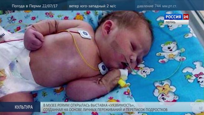 Предупреждаем опасность: симптомы и признаки врожденных и приобретенных пороков сердца, эффективные способы диагностики