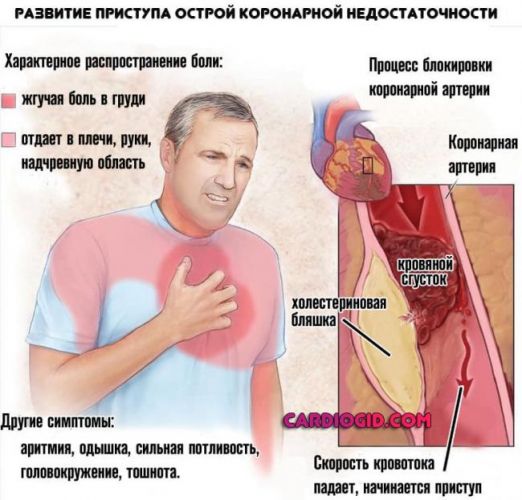 причины, признаки, симптомы и лечение
