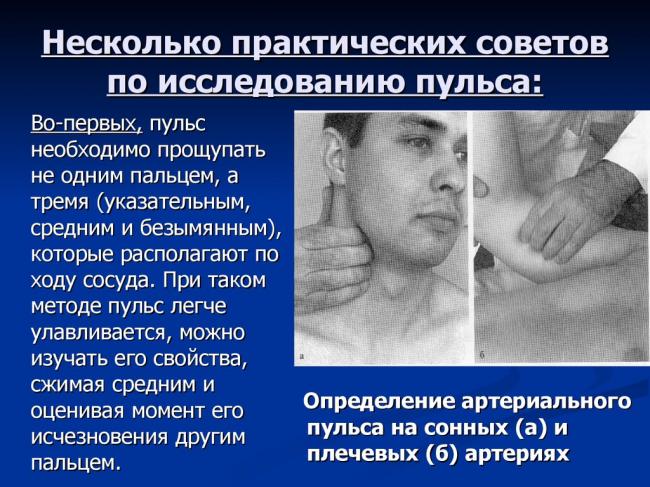 Aтеросклероз сонных артерий – причины и лечение